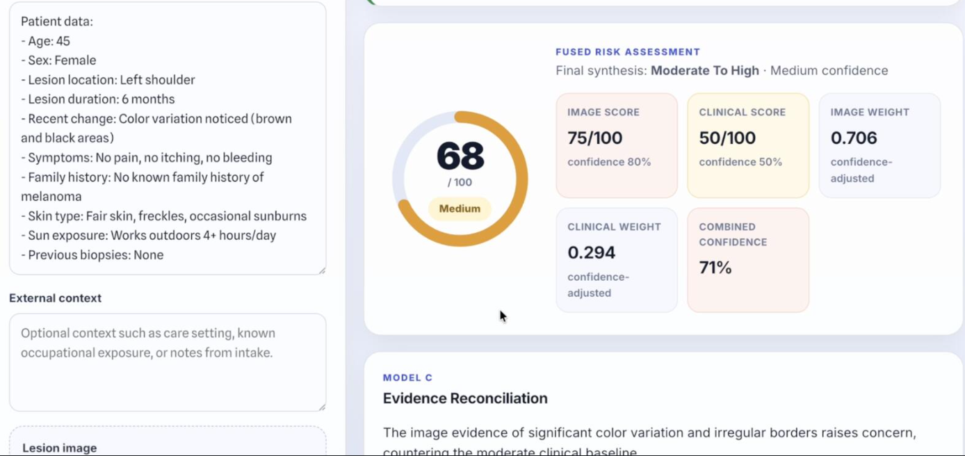 Melanoma clinical decision-support interface showing patient history, job status, and a fused risk assessment
